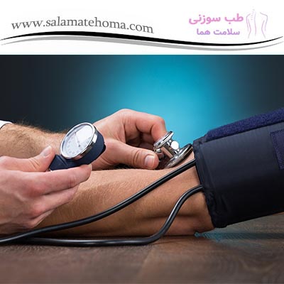  تاثیرات طب سوزنی در کاهش فشار خون بالا