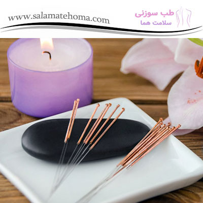 طب سوزنی برای بهبود تعادل بدن