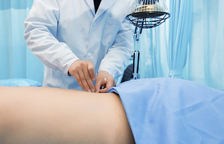  طب سوزنی در طب زنان: از درمان اختلالات قاعدگی تا تقویت باروری